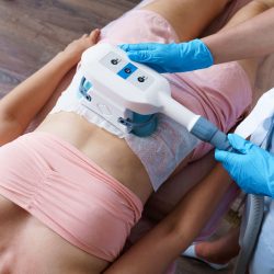 Kryolipolyse bei Skinlifter aesthetics in Berlin